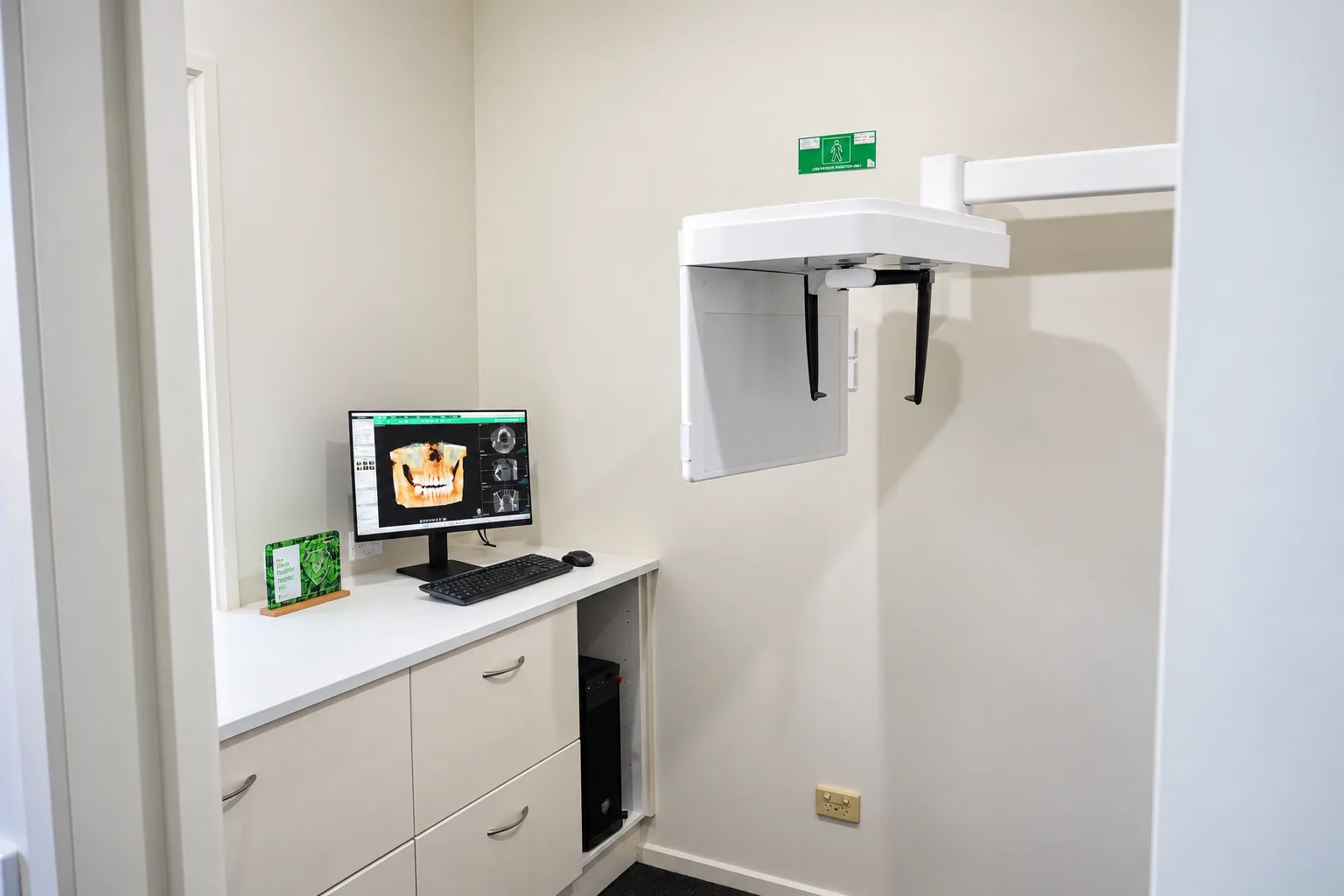 The 3D CBCT imaging room at Park Road Dental, with a scan displayed on the planning screen