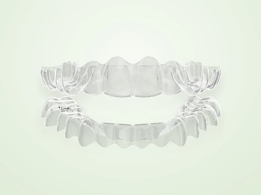A clear aligner tray — the near-invisible way to straighten teeth